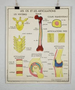 Scout Vintage French School Science Poster- Joints And Fractures 5 Scout Vintage French School Science Poster- Joints And Fractures