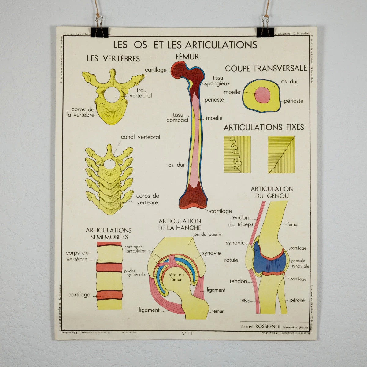 Scout Vintage French School Science Poster- Joints And Fractures 4 Scout Vintage French School Science Poster- Joints And Fractures