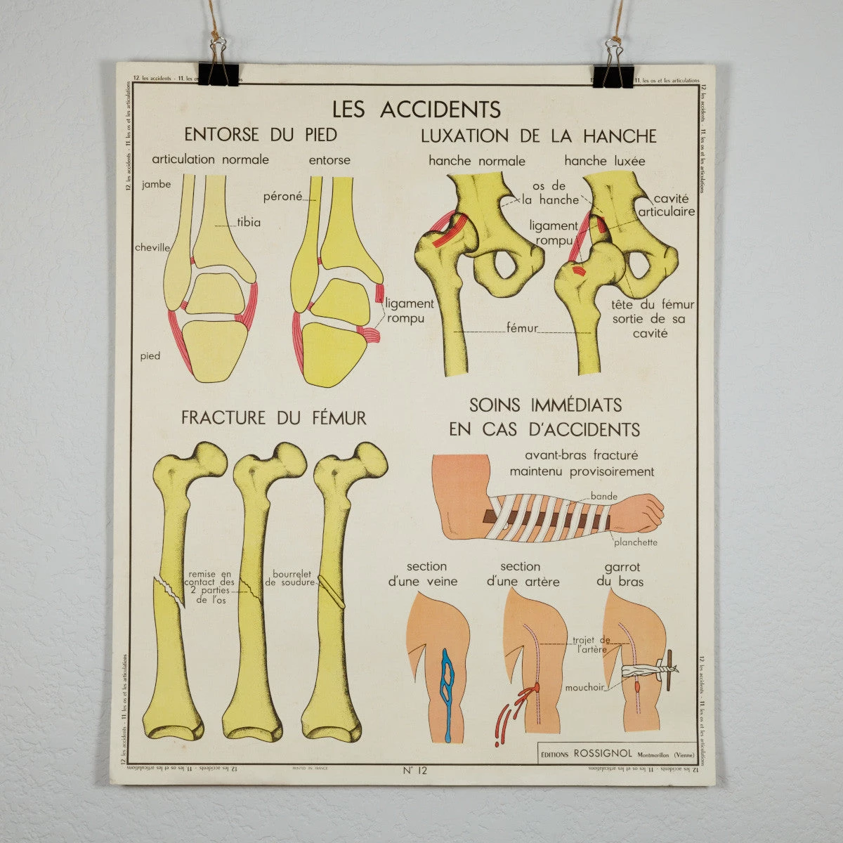 Scout Vintage French School Science Poster- Joints And Fractures 3 Scout Vintage French School Science Poster- Joints And Fractures